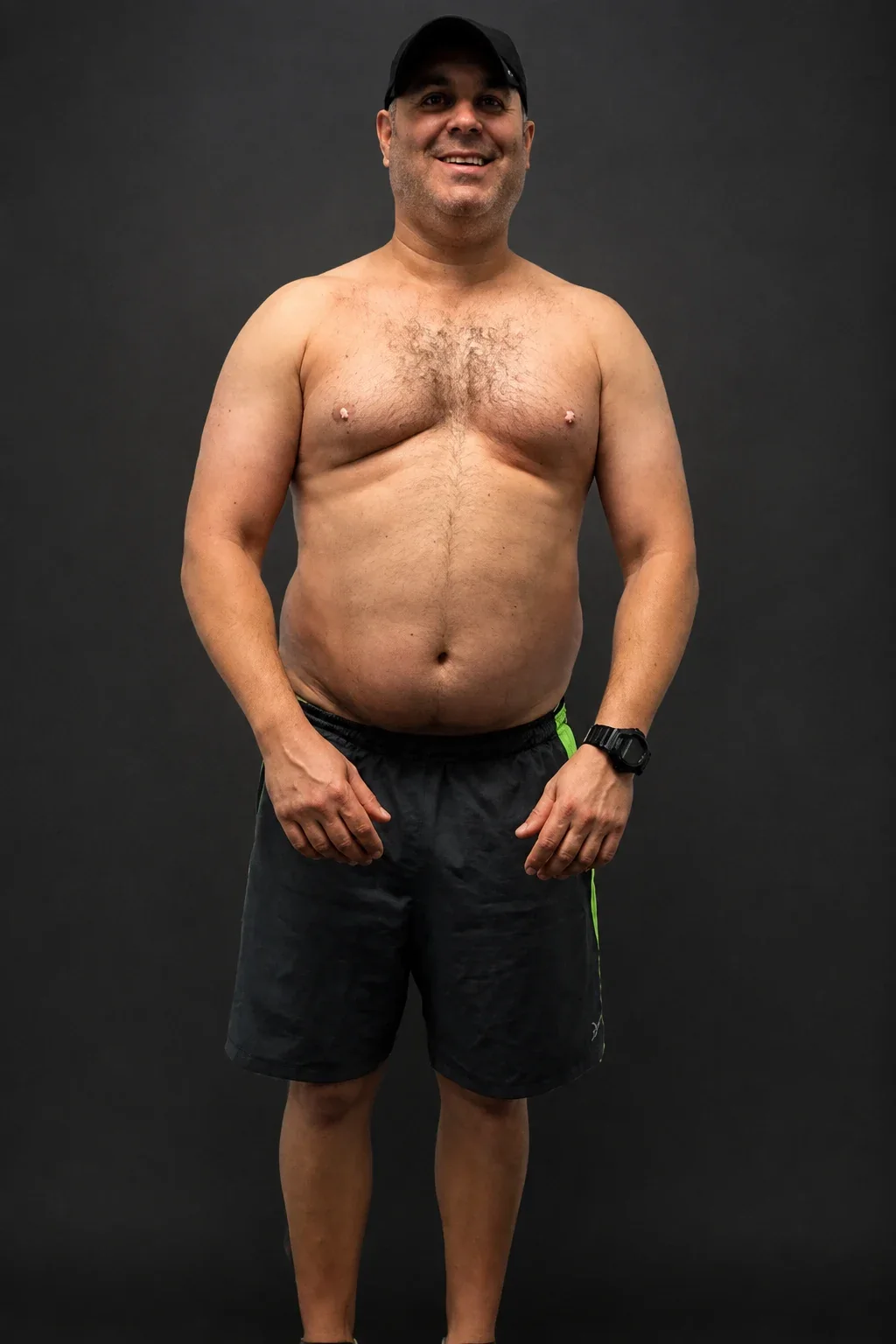 Brad Rose, before-and-after comparison: before