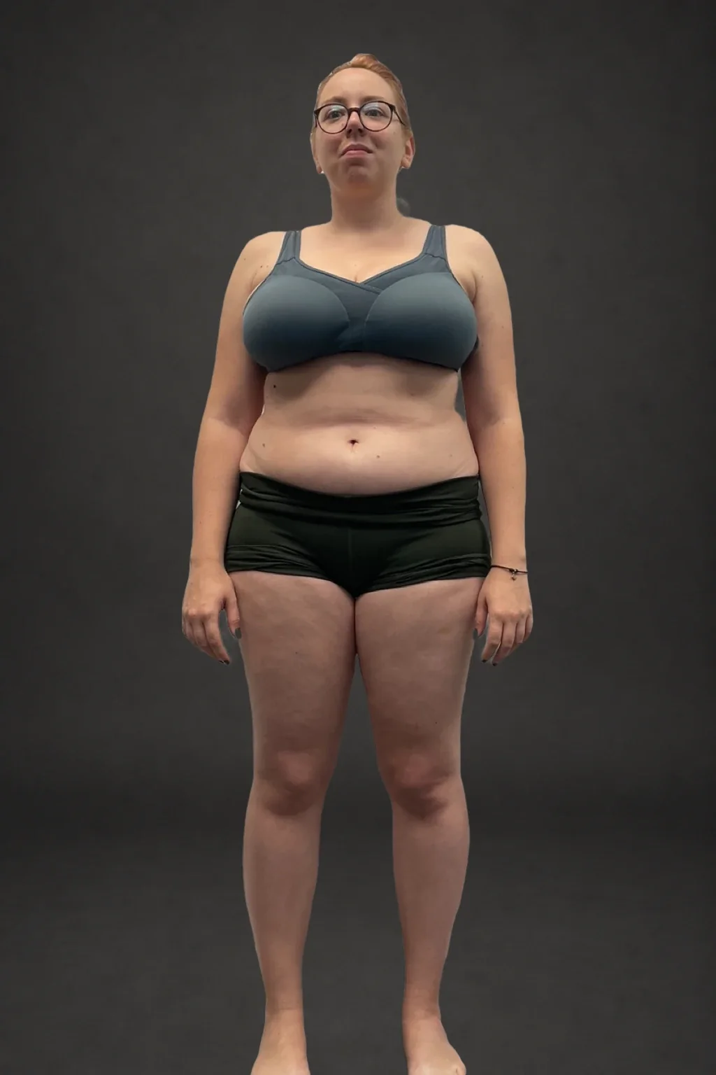 Magda Borgarelli, before-and-after comparison: before