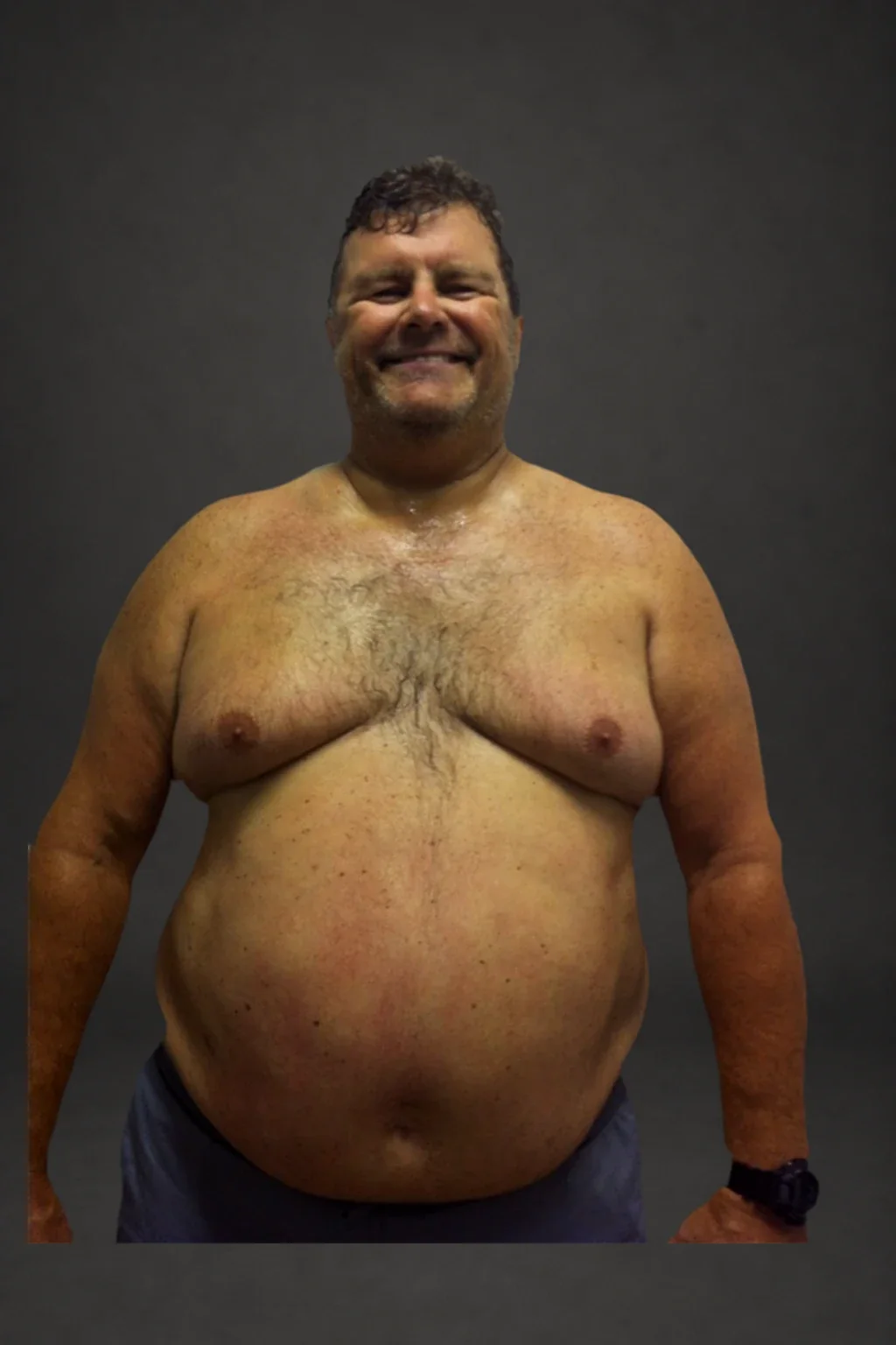Mark Johnson, before-and-after comparison: before