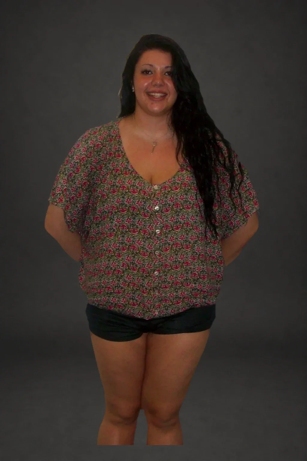 Laura McGinnis, before-and-after comparison: before