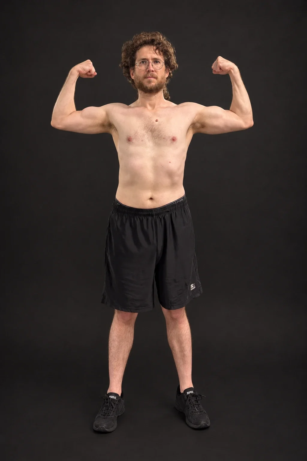 Nicholas Moran, before-and-after comparison: after