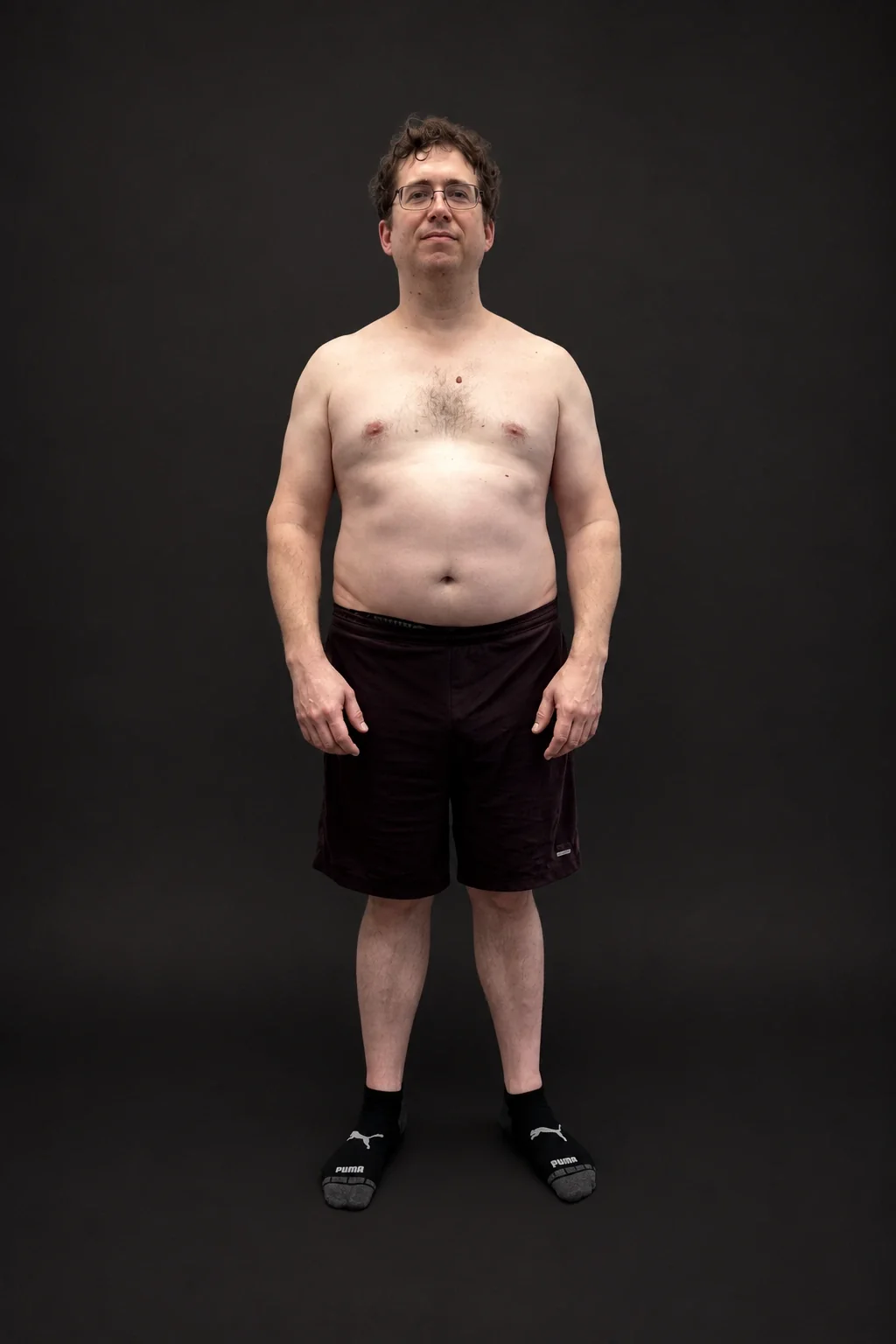 Nicholas Moran, before-and-after comparison: before