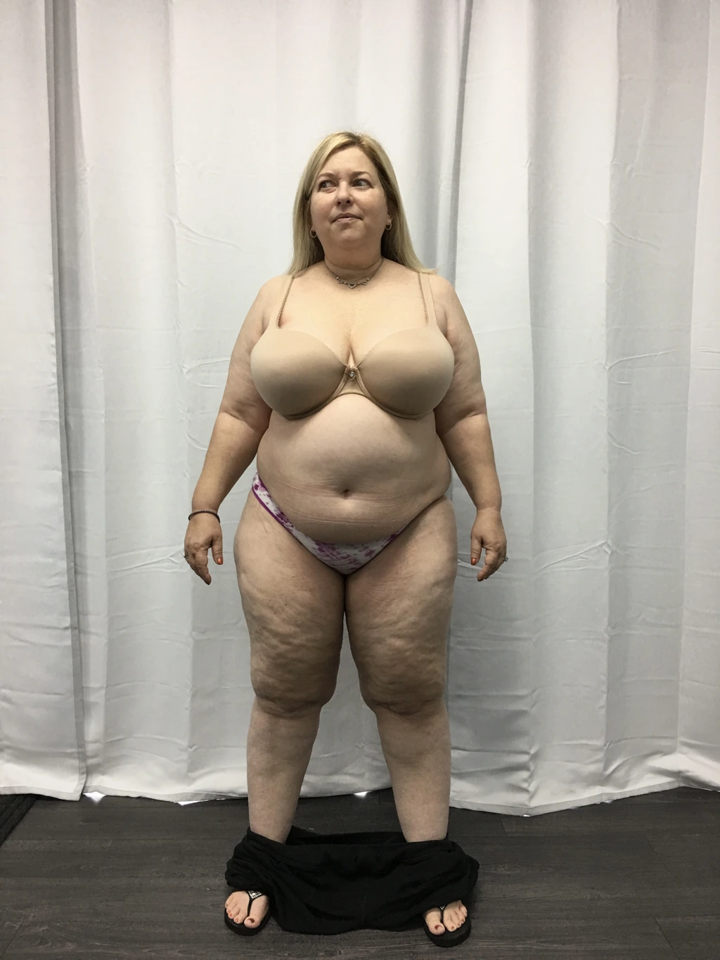 Wanda G., before-and-after comparison: before