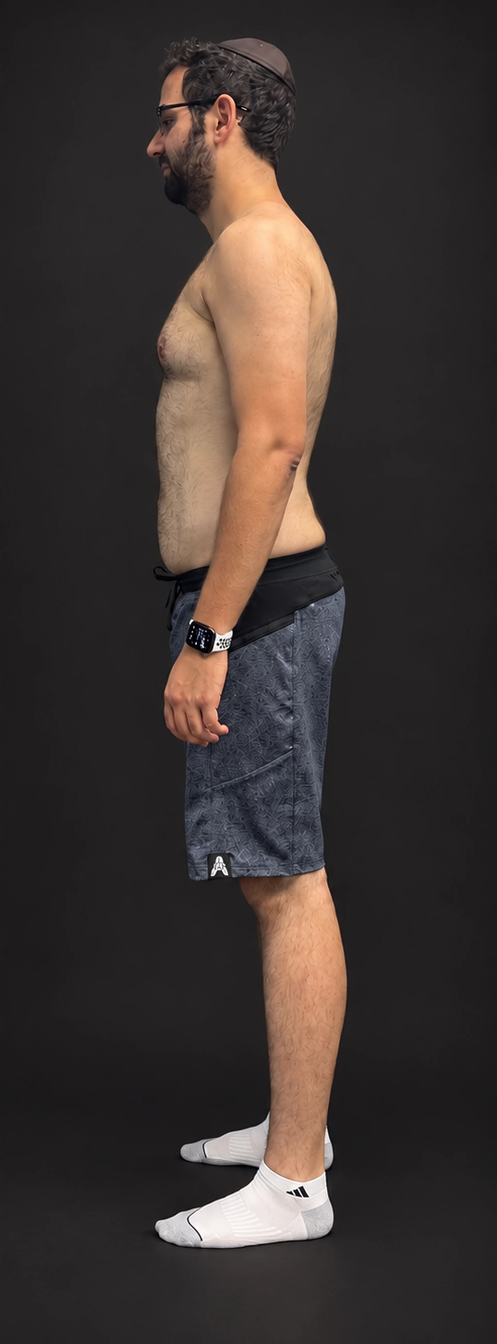 Shlomo H., before-and-after comparison: after